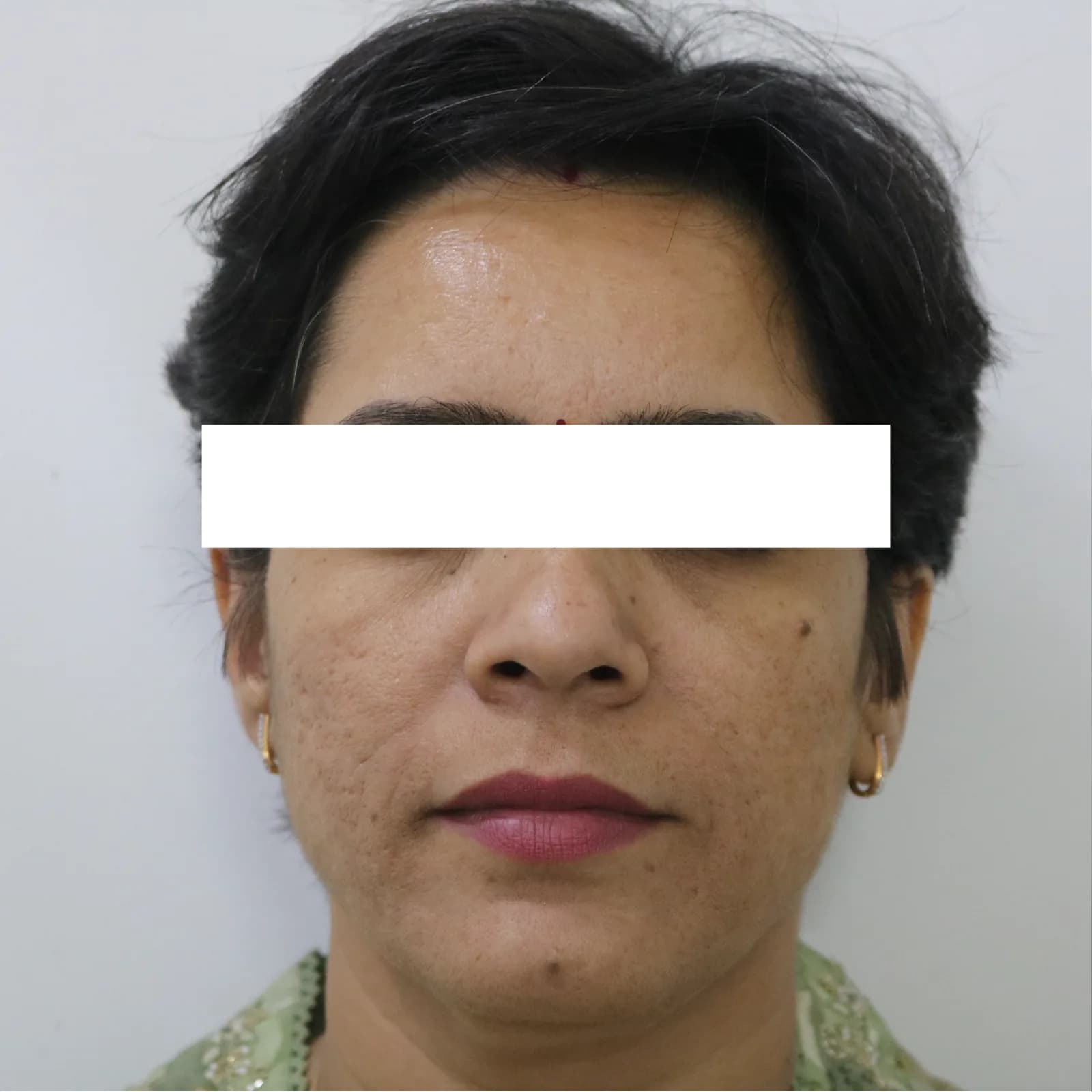 After Microblading