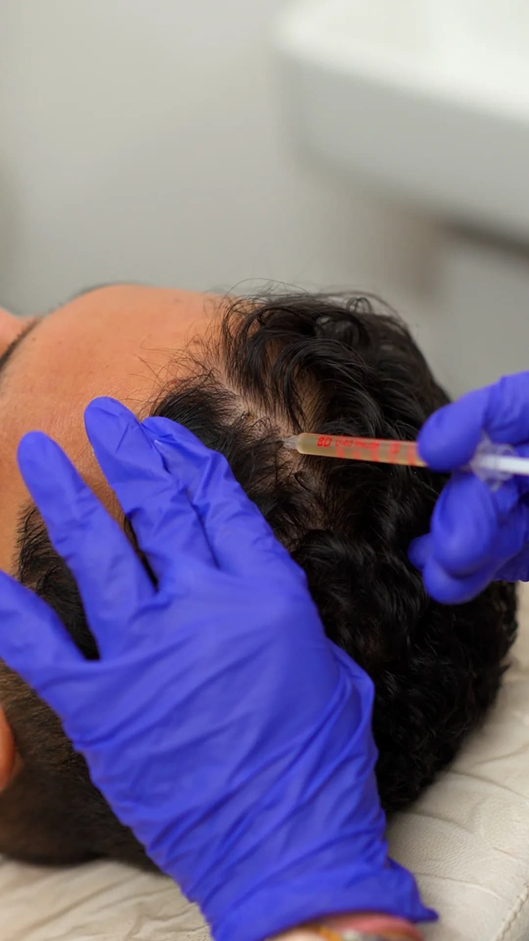 PRP Hair Therapy